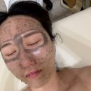 아임국민커피 평택고덕점 | 평택 고덕피부관리 더마인에스테틱 피코토닝 LDM물방울 후기