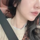 센텀한의원 | 센텀한의원 온다리프팅 받으러 갔다가 패인 흉터까지 정리하고 온 썰