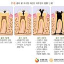 서울테라치과 이미지