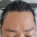 두한에너지 2 | 권선동 망포동 헤드스파 및 두피관리 전문 스페이스뷰티 권선점 탈모 초입 40대 남성두피관리 후기