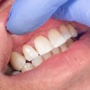 예스치과기공소 이미지