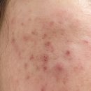 힐비뇨기과의원 이미지