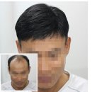 심는가발 이미지