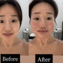 홈인팜스 | 🍃 제주 서귀포 영어교육도시 인근 팜스뷰티 1:1 맞춤 리프팅 관리 후기 🍃