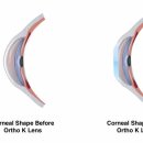 드림안경콘택트 이미지