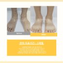 신장_어린이5호(새나라) | 다리에 작은 붉은 반점, 생겼다면? &lt;한의사 고백&gt;