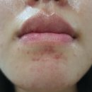 아크네마인드의원 이미지