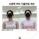 드림빌딩 | 창원 용호동 전방경사 라운드 숄더 자세 교정 “밸런스드림 체형분석 운동센터” 후기