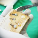 닥터안헤어플란트의원 | 닥터안헤어플란트의원 안지섭, 재수술피해야