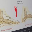 알즈너 점프 대리점 이미지