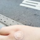 강동원약국 | 압구정 라봄 코 수술 당일 리뷰