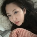 멍쉐프 | [쌍수일지] ㅇㅁㄷ자연유착 6~10일차 후기｜붓기·멍·회복기간 리얼 정리