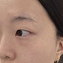 미드림성형외과의원 네이버블로그