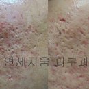 연세지움 Daum카페