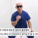 빡빡이