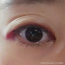 아이레이저랩 | 10년 된 아이라인 반영구 제거 1회차 시간대별 후기 (보호렌즈, 피코 레이저)