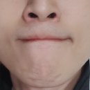 에이치봄의원 이미지