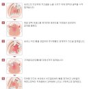 [에이블성형외과]돌출입 수술방법과 치아교정과의 차이 이미지