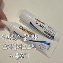 스카스 | 수술 흉터 관리 필수템 더마틱스 울트라겔 실제 사용 후기(내돈내산!!!)