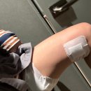 부산 허벅지 지방분해주사 가격 효과 2회차 내돈내산 후기