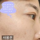 아름다운피부 | 토니모리 모찌토너 예민한 피부진정에 딱! 민감성 피부에 사용 후기.