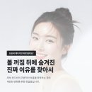 삼성동 피부과 비티큐의원 콜라겐과 볼륨을 함께 보는 기준