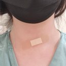 생각했을땐 진짜로 X된거맞습니다... 갑상선 세침검사(조직검사) 후기 / 보라매병원, 강남 세브란스병원