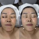 아띠드뷰티 네이버블로그