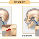 턱편한세민치과 네이버블로그