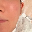 태화메디 | 서면 피부관리 데자뷰메디스킨 부산점 진정관리 솔직 후기