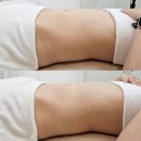 전주송천동마사지 체형관리샵에서 복부관리 받은 후기_솜이경락 전주에코시티점