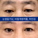 아이케이성형외과의원 네이버블로그