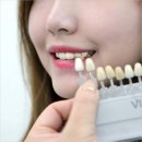 미백세탁 이미지