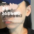 뽀야니스킨바디 | 제이스킨앤바디 석사동피부관리 문제성피부 수분관리 받은 후기