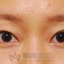 에이엠성형외과의원 네이버블로그