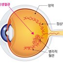 아일리아 vs 비오뷰 이미지