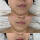 미인본가구미점 | [구미] 구미피부관리 형곡동 피부맞춤PT '어여쁘다'