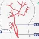 “고혈압∙당뇨 있다면? 뇌졸중 예방 위해 ‘이 검사’ 받아야” [인터뷰] 이미지