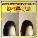 헤어;든 | W9. 김해왁싱 김해율하왁싱 김해왁싱잘하는곳 녹아든뷰티 헤어라인 왁싱 후기
