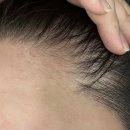 아인뷰티랩 분당눈썹 | 분당입술헤어라인잘하는곳/분당아인뷰티랩