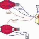 전기 근육 자극 치료 (EMS electromyostimulation) 이미지