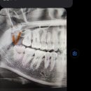 동묘대찬치과의원 | 사랑니. 동묘. 브라질리언 레이저.