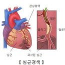 가슴 답답함 심하면 원인 알아볼까요? 이미지