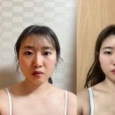선명한의원 | 서면한의원 온다리프팅 LDM 부산리프팅후기 일주일