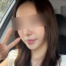 오룸스킨 | 대구스킨부스터 고우리스킨부스터 2주차 찐 후기 | 대구수성구피부과 스킨부스터 효과
