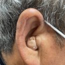 스타키보청기 안동점 이미지