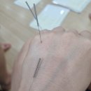 사랑방한의원 | 우리동네 이상한 한의원 5개월 후기
