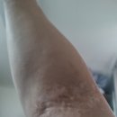 설상훈심사랑내과의원 | 피부과, 바자회 또 현지의 깜짝 선물!!