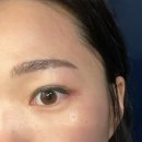 르노삼성자동차수성점 | [대구눈썹/수성구자연눈썹] 프레야뷰티 솔직후기(탈각과정포함)