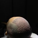 A Time for Choosing | Korean expectation for turkey hair transplant